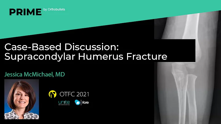 Supracondylar Humerus Fracture - Jessica McMichael...