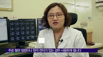 간암의 항암치료 [AMC 병법]