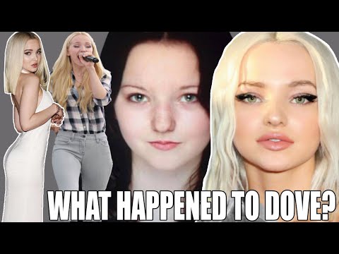 DOVE CAMERON - THE TRUTH BEHIND THE GLOW UP. PLASTIC SURGERY?