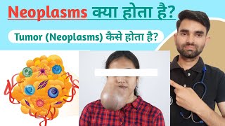 Neoplasm in Hindi | Neoplasm Kya Hota Hai | Neoplasm Kya Hai