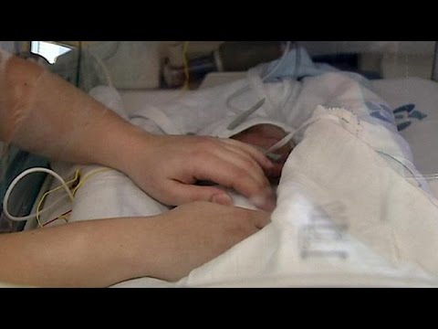 Video: Nació En Azerbaiyán Un Bebé Con La Cara Terriblemente Desfigurada