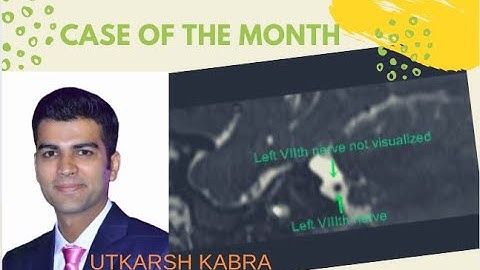 TMT: Case of the Month by UTKARSH KABRA