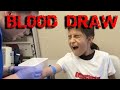 Blood draw