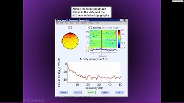 Independent components analysis for removing artifacts