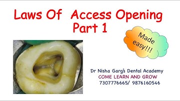 LAWS OF ACCESS CAVITY PREPARATION | DR NISHA GARG