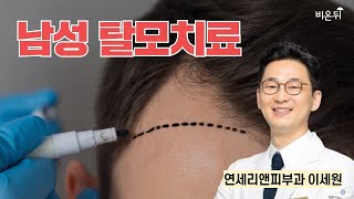 남성 탈모치료 - 조기 남성형 탈모 (연세리앤피부과 이세원)