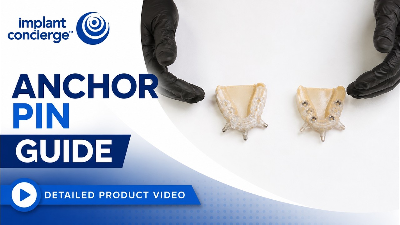 Anchor Pin Guide - YouTube