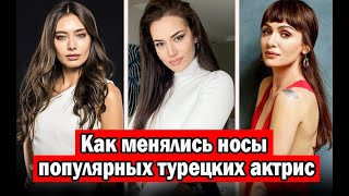 Как менялись носы популярных турецких актрис