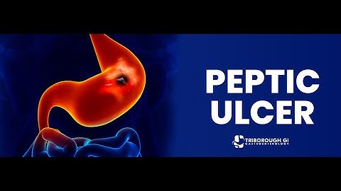 peptic ulcer