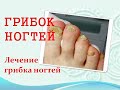 Грибок ногтей. Как можно и нужно лечить разные формы грибка ногтей. (часть 2).