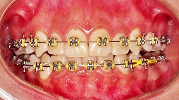 Get ready for a perfect smile and improved oral health.”