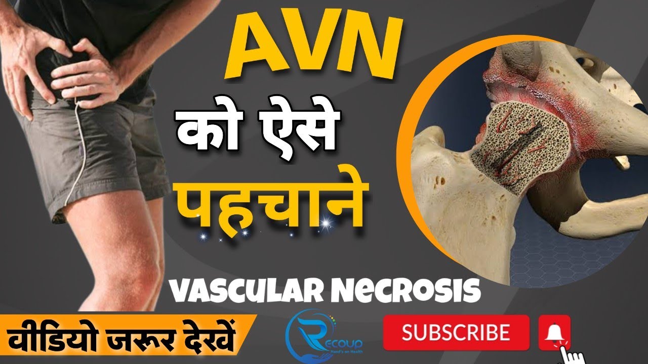 AVN hip ko kese pehchane. AVN hip Treatment without surgery. कुल्हे का