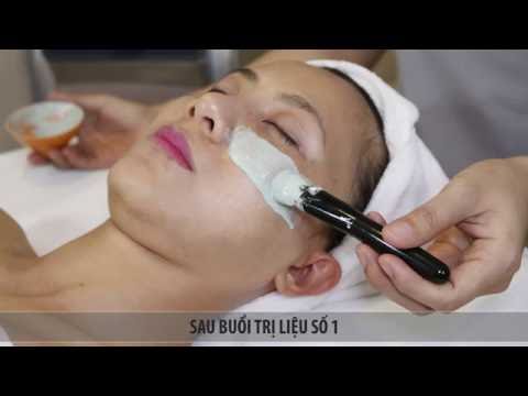 Nhật ký làm trắng da Kiểu Nhật tại Saigon Smile Spa