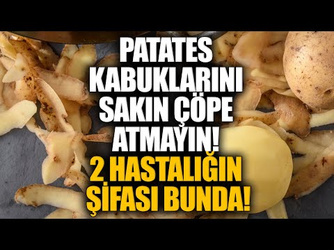 Patates Kabuklarını Sakın Çöpe Atmayın! 2 HASTALIĞIN ŞİFASI BUNDA!