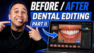 How to Edit Dental Photos Part II:  Matching Skin Tones like a Boss! screenshot 5