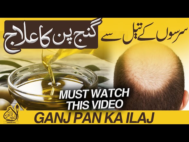 Ganjpan Khatam Karne Ka Tarika | Wazifa for Hair Problems | Ganjapan Ka ilaj | How to Stop Hair Fall class=