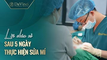 Review sửa mí sau 5 ngày thực hiện  tại thẩm mỹ viện Davinci