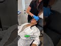 Getting ready for her third Aerolase treatment, and the results have been amazing! After just the