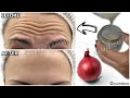 1 onion is a million times stronger than Botox, it eliminates wrinkles and fine lines instantly