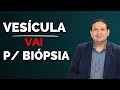CIRURGIA DE PEDRA NA VESÍCULA - Porquê a vesícula vai para biópisa depois da cirurgia de vesícula?