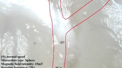 Manipulation of the helical and spherical microrobots in a rat brain blood vessel