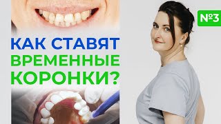 Протезирование зубов / Установка временных коронок