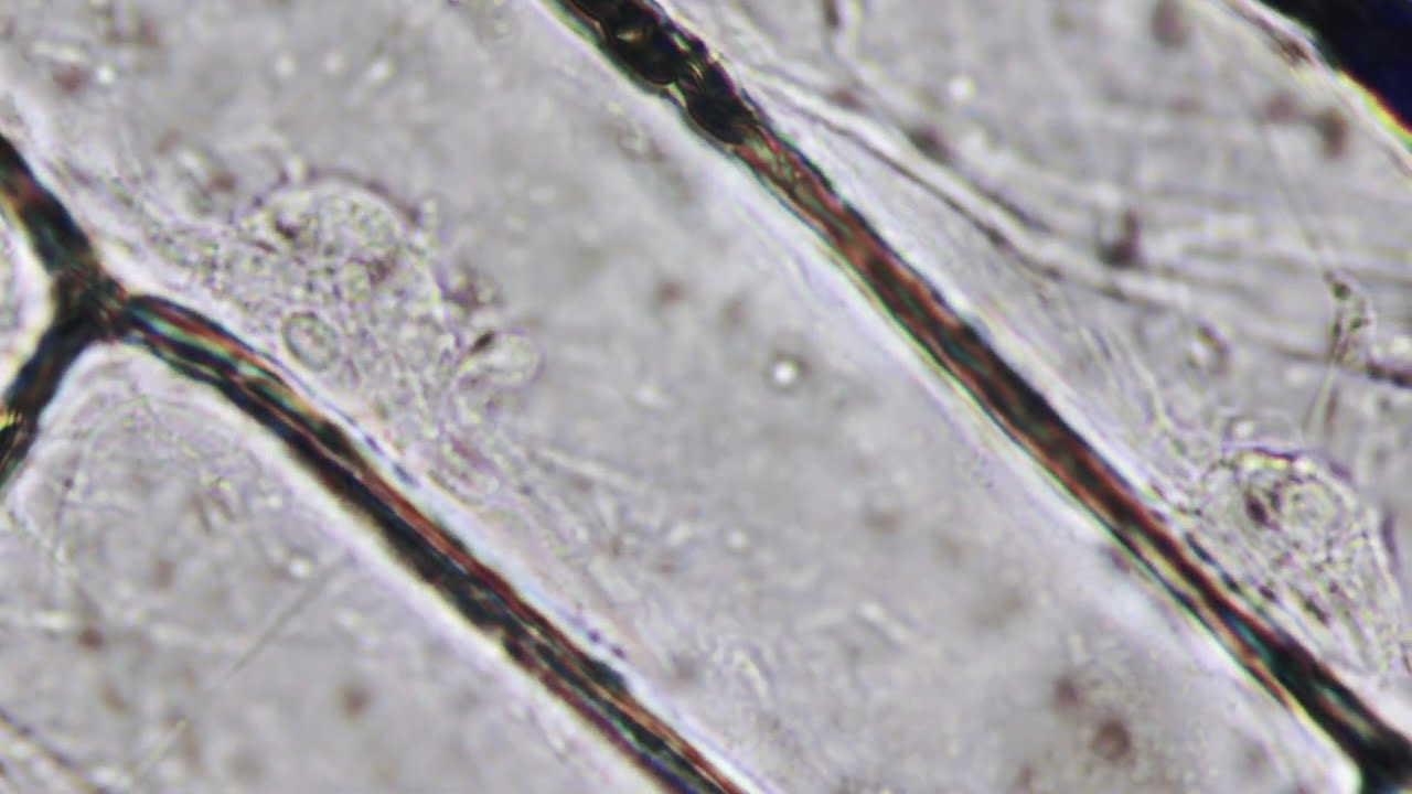 Life in Motion: Cytoplasmic Streaming