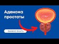 Аденома простаты | Гиперплазия предстательной железы