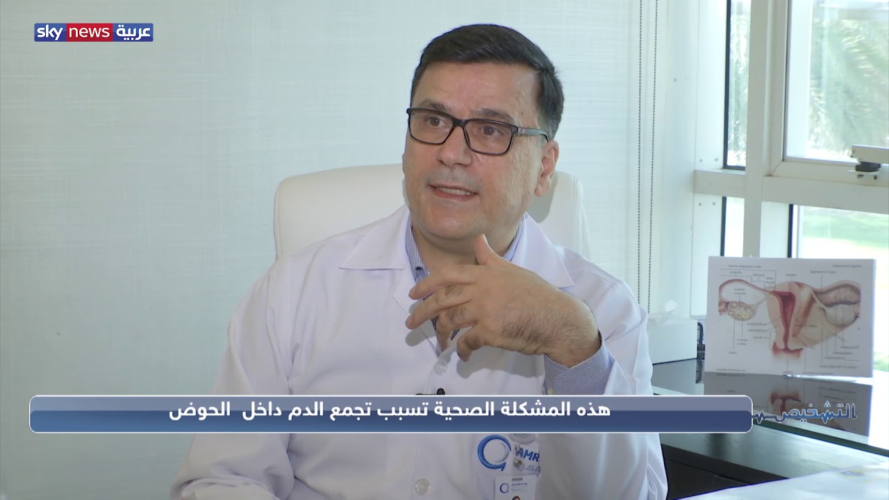 التشخيص.. مرض بطانة الرحم المهاجرة