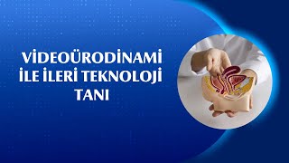 Videoürodinami Testi Nedir, Nasıl Yapılır, Kimlere Uygulanır?