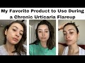 Chronic Urticaria Update &amp; My Favorite Product to Use During a Flareup