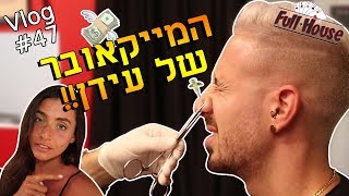 המייקאובר של עידן! הוא צרח מכאבים