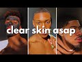 How to get clear skin for guys asap no bs guide
