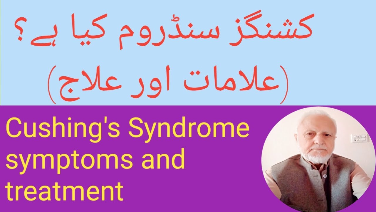Синдром Кушинга | Лечение синдрома Кушинга | Аптека Javedan.