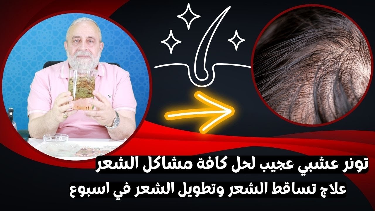 تونر عشبي عجيب لحل كافة مشاكل الشعر | علاج تساقط الشعر وتطويل الشعر في اسبوع