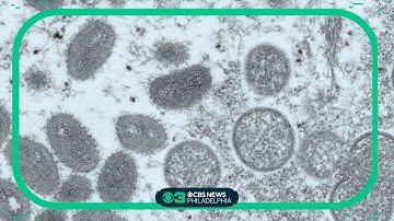 CDC warns of a possible Monkeypox resurgence this summer