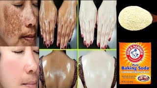 Instant Skin Lightening Pack|| How to use Baking SodaFor Skin Whitening bleach at home