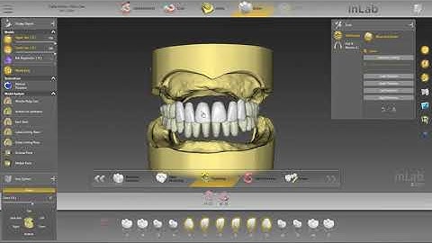 inLab SW 20 Tutorial 3b (EN) - Digital Dentures – Design – IPN 3D Digital Denture Teeth