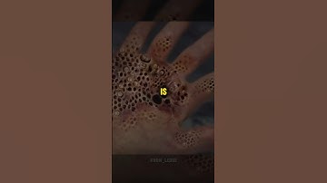 Why Do We Fear Small Holes? 😱😱 #trypophobia #shorts