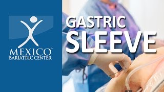 How Gastric Sleeve Works | Animation