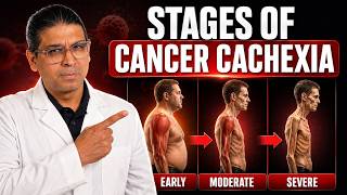 Stages of Cancer Cachexia Explained | Pre-Cachexia, Cachexia and Refractory Cachexia