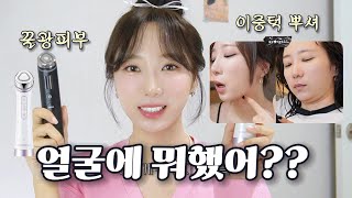 살빠졌어? 얼굴에 뭐했지? 예뻐졌다? 미세하게 확실히 다른 뷰티디바이스 2종 전.격.비.교 ㅣ 센텔리안24 마데카 프라임, 메디큐브 에이지알 부스터프로