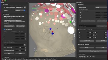 MNE-Python Tutorial on Coregistering EEG Digitization Points with an MRI