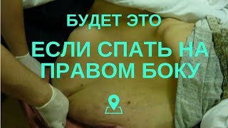 Если спать на правом боку, то можно заболеть. На каком боку спать правильно и почему?