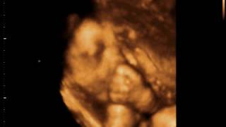 Ellyza Ultrasound21