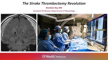 11-13-2025 - The Stroke Thrombectomy Revolution