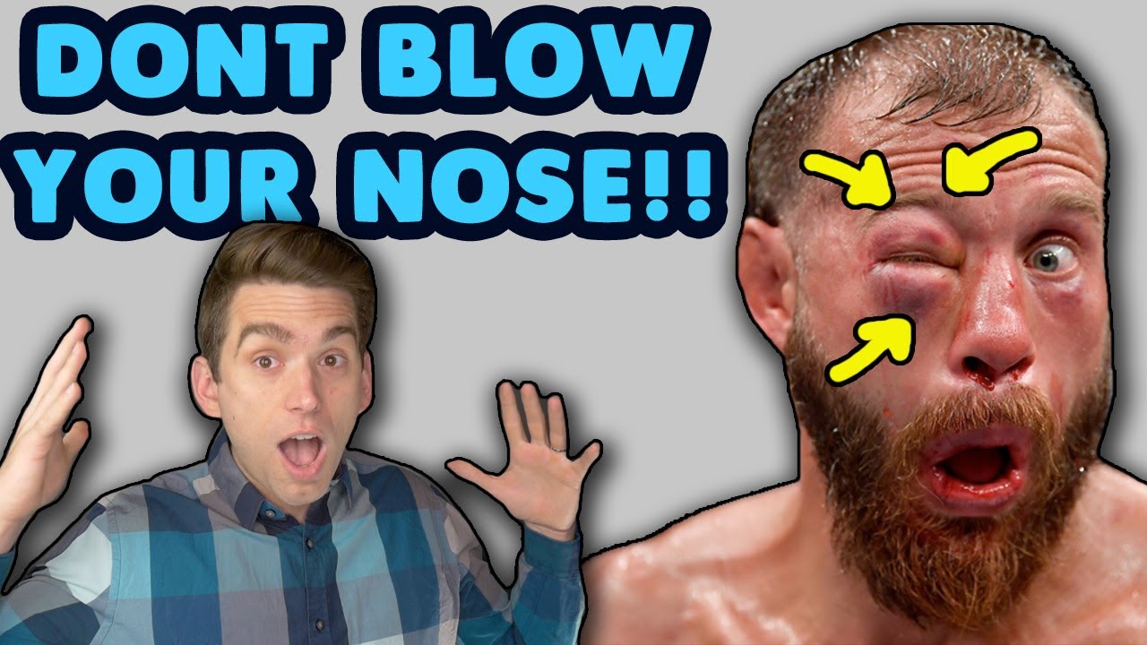 doctor-reacts-to-donald-cerrone-eye-swollen-after-he-blows-nose-at-ufc
