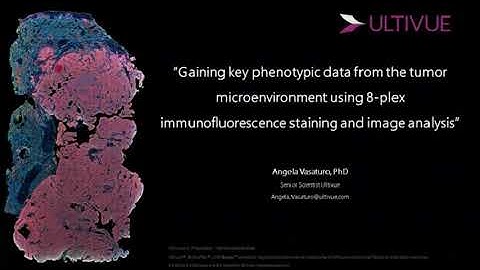 Gaining key phenotypic data from the TME using 8-plex immunofluorescence staining and image analysis