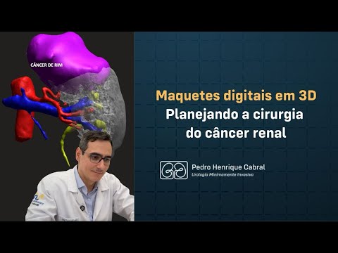Ver vídeo
