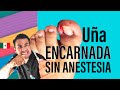 Cómo sacar una uña encarnada infectada, sin anestesia y sin dolor. Reto a Podólogos